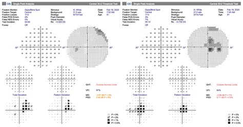 Man Presents With Unilateral New Blind Spot