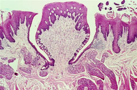 Lm Of A Papilla On The Tongue Showing Taste Buds Photograph By Biophoto