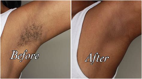We did not find results for: 39 Best Pictures How To Wax Armpit Hair - Underarm Waxing ...