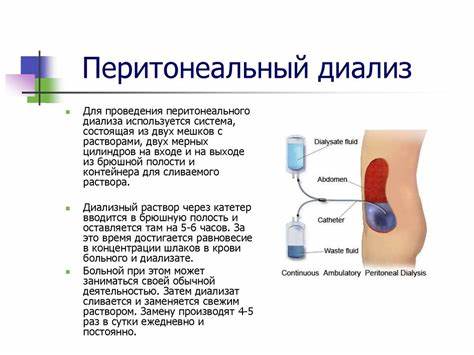 Перитонеальный диализ диета Лечение детей с заболеваниями органов мочевыделения. Острый пиелонефрит Лечение детей с заболеваниями органов мочевыделения. Острый пиелонефрит Перитонеальный диализ диета