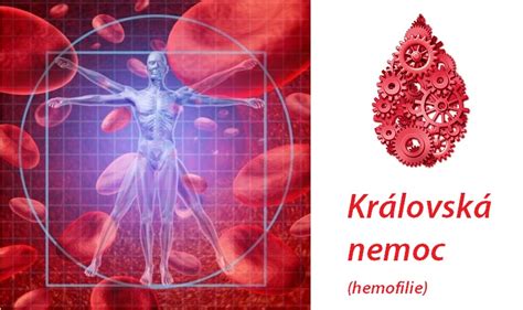 Atunci cand o persoana sufera o taietura, corpul se protejeaza, in mod natural. Královská nemoc (hemofilie) - příznaky, projevy, symptomy ...