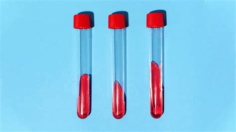 Blood Collection Tubes And Tests Chart