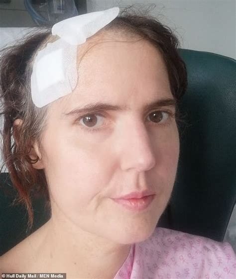 Mothers Tooth Abscess Led To A Life Threatening Infection On Her Brain