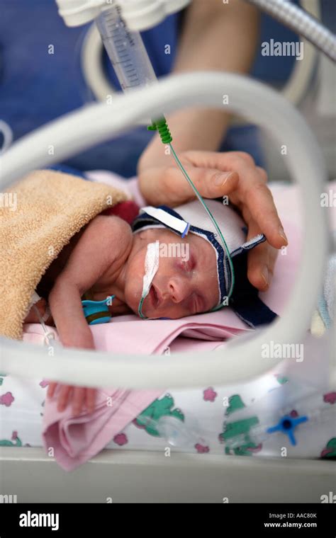 Premature Baby Hi Res Stock Photography And Images Alamy