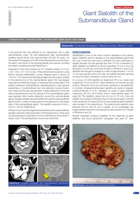 Pdf Giant Sialolith Of The Submandibular Gland