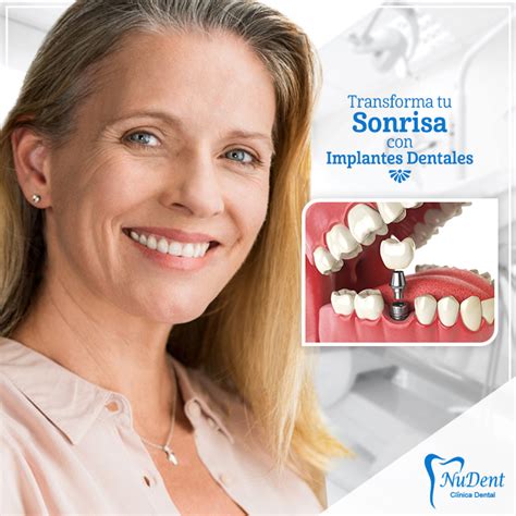 Estética Dental Clinica Nudent Trujillo Ortodoncia Implantes