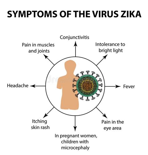 Zika Virus Structure Zika Virus Infection Sexually Transmitted Diseases Infographics Vector