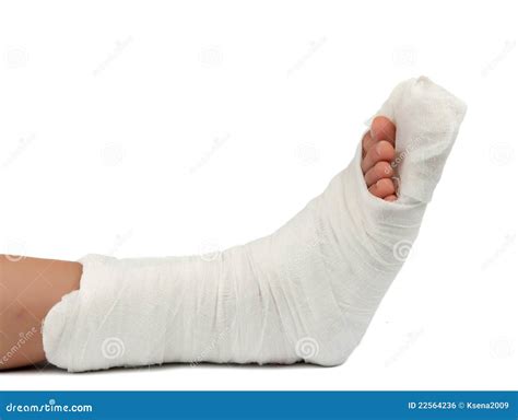 Leg In A Plaster Cast Royalty Free Stock Image Image 22564236