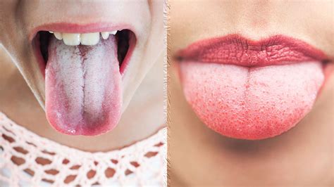Deep your finger, the cotton of earbud inside the water and gently put your hand in the baby's mouth. How To Keep Your Tongue Clean - The Benefits of Tongue ...