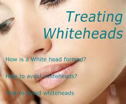 And not only does it combat clogged pores. Simple Beauty tips: How to treat whiteheads?