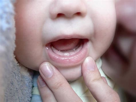 When Do Baby Teeth Come In All You Ever Wanted To Know — Caring