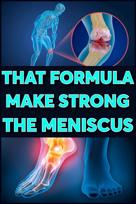 How To Heal A Torn Meniscus Naturally Unugtp News