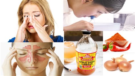 Home Remedy For Sinus Infection How To Cure Sinus Infection