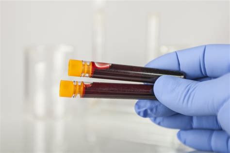 Blood Test Can Detect Classify Cancer In The Body