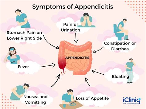 Appendicitis Types Signs And Symptoms Causes Risk Factors