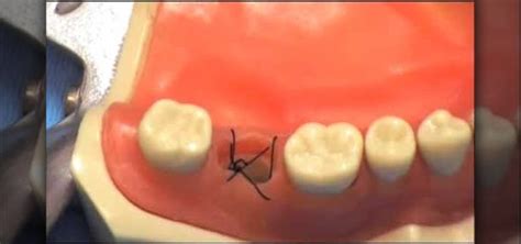 How To Tie A Figure Eight Suture In Someones Mouth Dentistry And Oral
