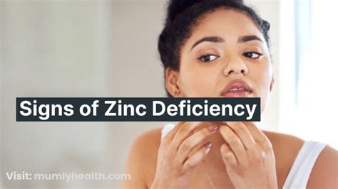 Signs Of Zinc Deficiency Cause Symptoms And Treatment
