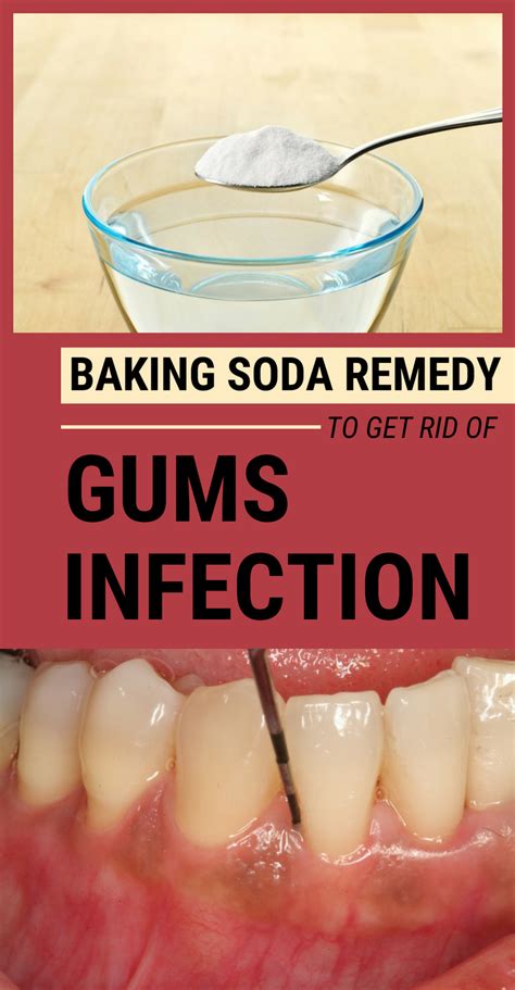 When a foreign body gets under your gums, your. Is Baking Soda Good For Teeth And Gums - TeethWalls