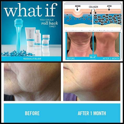 Accidentally bumping into a cactus is painful enough, but the spines often remain in the skin as a natural much like using glue, wax hair remover spread across your skin pulls the cacti spines out much better than duct tape. Roll back time with Rodan + Fields Amp Roller - a patented ...
