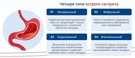 Острый гастрит диеты Острый катаральный гастрит: симптомы, причины, лечение Острый катаральный гастрит: симптомы, причины, лечение Острый гастрит диеты