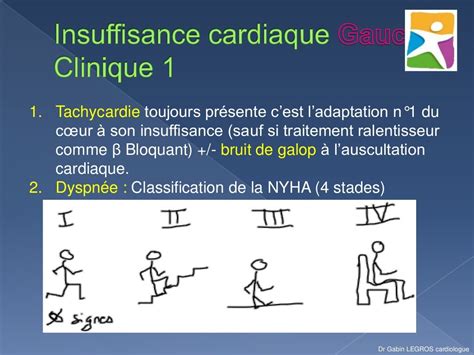 Insuffisance Cardiaque