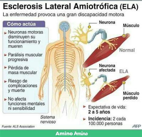 Reportaje a ágata, una enferma de ela, con la participación de la doctora clara cabeza, neurólogo del centro médico enova, en la televisión autonómica de. Teoría: La enfermedad de Kaori Miyazono y la inspiración ...