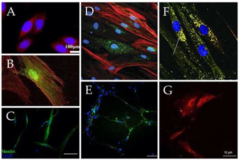 Biomolecules Free Full Text Mesenchymal Stem Cells As A Promising Cell Source For