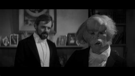 The elephant man is based on a true story. The Elephant Man Review :: Criterion Forum