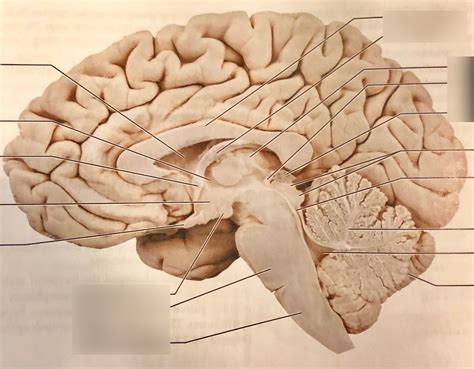 Midsagittal Brain Diagram Quizlet