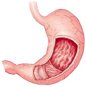 Signs of cancer in dogs. Gastric Torsion Symptoms In Humans