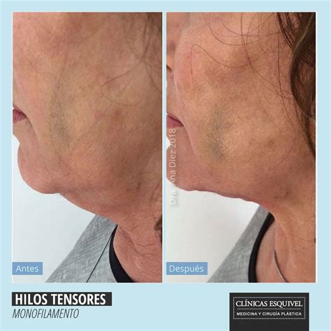 Simple Science: How to Make a Volcano with Kids