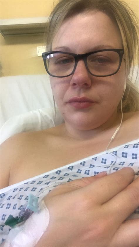 Mum Left Vomiting Blood Every Day After Gastric Band Slipped