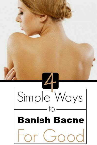 Health Matters 4 Simple Ways To Banish Bacne For Good With Images