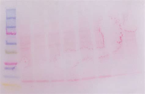 What Are These White Spots On My Ponceau Stained Western Blot