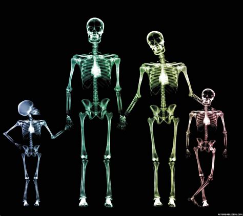 X Ray Skeleton