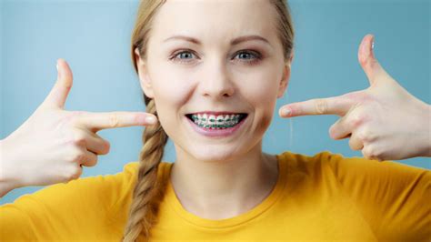 7 Things You Should Know Before You Get Braces Treatment Women Health Tips