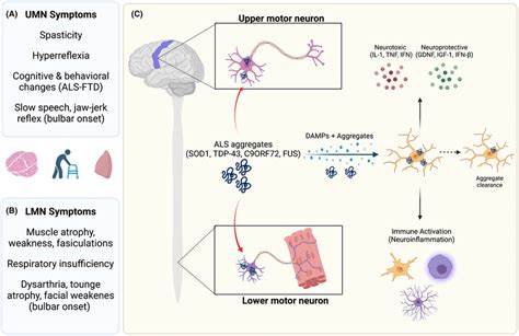 Amyotrophic Lateral Sclerosis Als Symptoms And Pathogenesis Patients