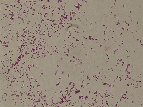 Gram Stain Picture Of Corynebacterium Diphtheriae Showing Gram Positive