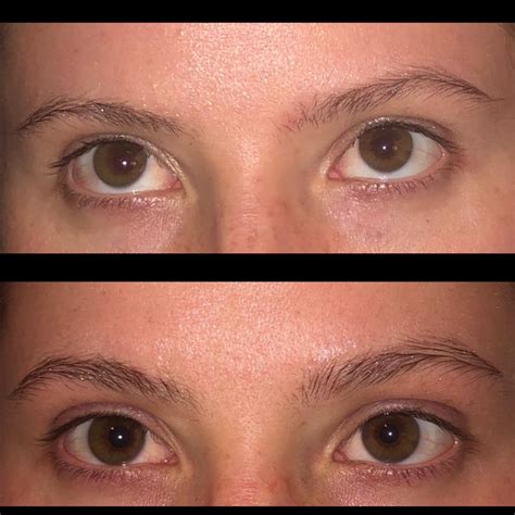 Eye Brow Growth A Week And A Half Of Using Castor Oilolive Oil
