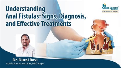 Anal Fistulas Signs Diagnosis And Effective Treatments By Dr Durai Ravi Apollo Spectra