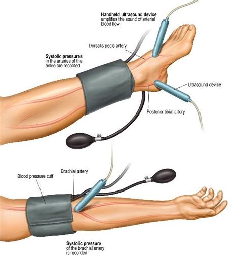 Lower Extremity Blood Pressure Technique