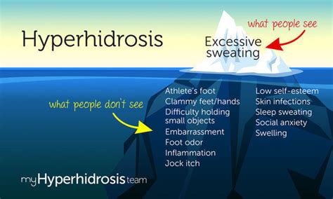 Hyperhidrosis What People Dont See Infographic Myhyperhidrosisteam