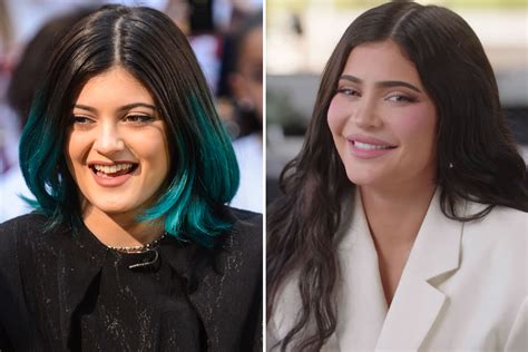Kylie Jenner S Fans Think Pregnant Star Got Veneers As Her Teeth Look Totally Different From