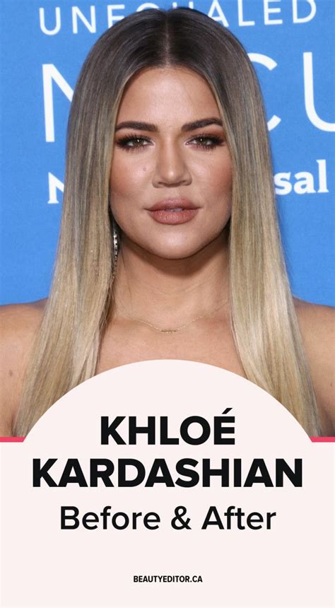 Since 2007, she has starred with her family in the reality television series keeping up with the kardashians. Khloé Kardashian, Before and After (With images) | Khloe ...