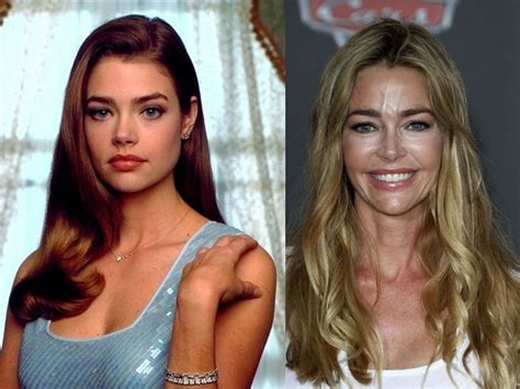 Denise Richards Before And After Plastic Surgery Boob Face