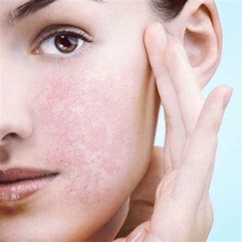 Sensitive Skin You May Think That If You Have Very Sensitive Skin Or Skin That Has A Red