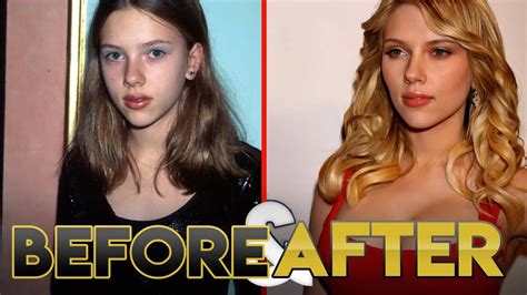 Scarlett Johansson Before And After Plastic Surgery
