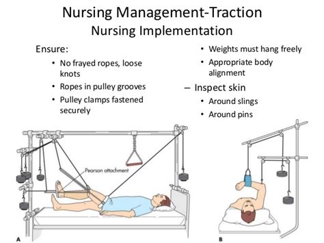 Keep all weights hanging free. Orthopedics for nurses
