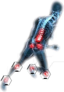 Learn vocabulary, terms and more with flashcards, games and other study tools. Treatment of Sports Injury | Chiropractor Near Me