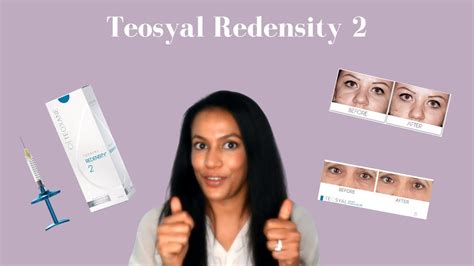 Teosyal Redensity 2 Under Eye Filler Tear Trough Filler Explained
